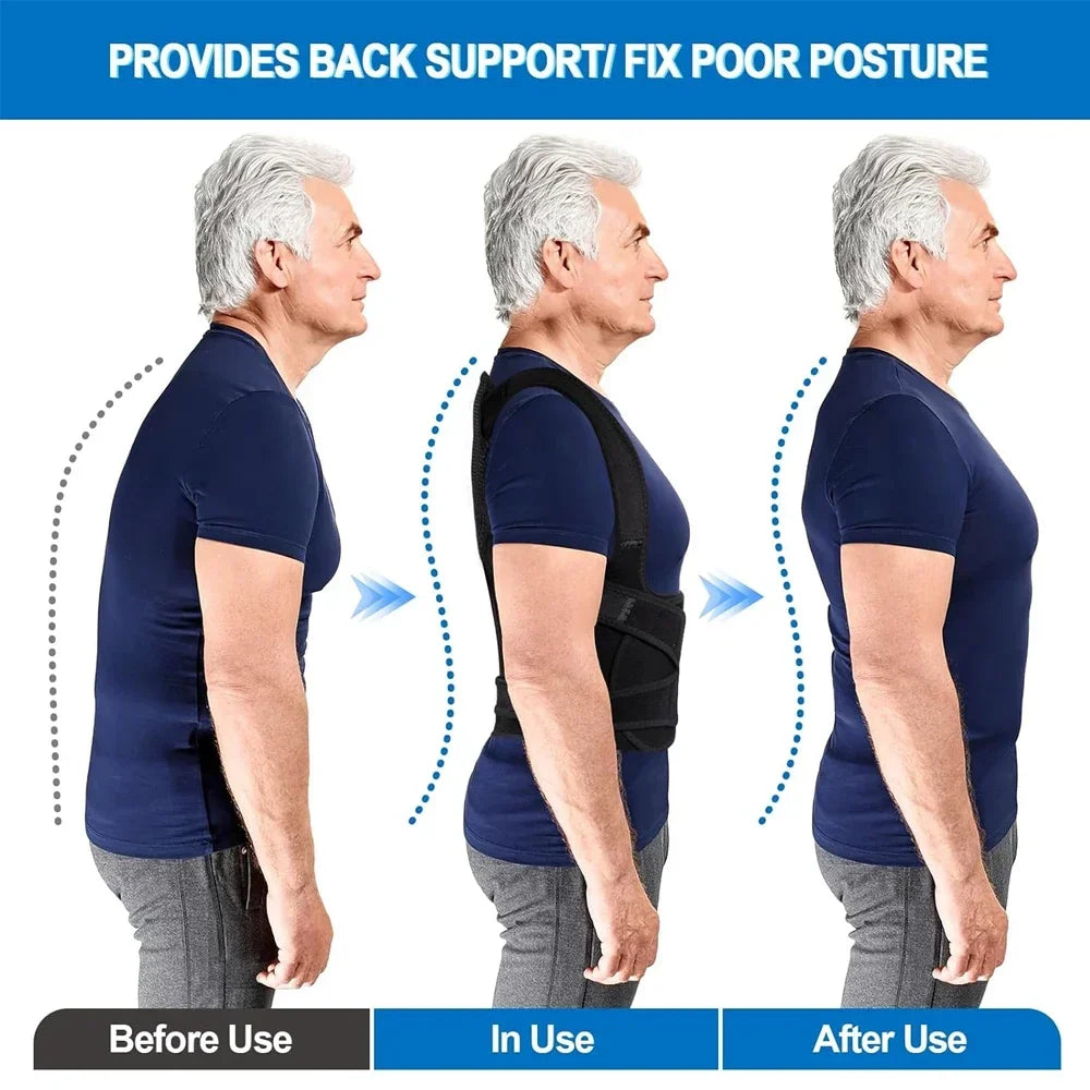 Back Support Brace Posture Corrector for Women and Men Back Straightener Posture Corrector Scoliosis and Hunchback Correction